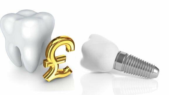Controlling costs and increasing access to dental implant treatment