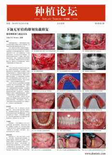 Implant Tribune China No. 1, 2014