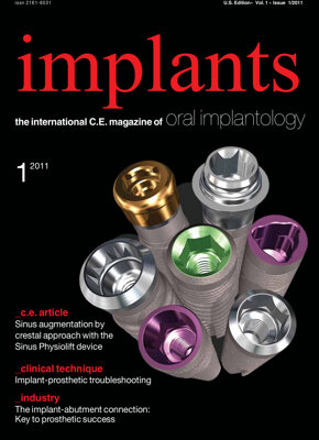 implants C.E. No. 1, 2012