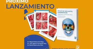 Introducción del “Atlas de implantes cigomáticos”