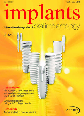 implants international No. 1, 2015