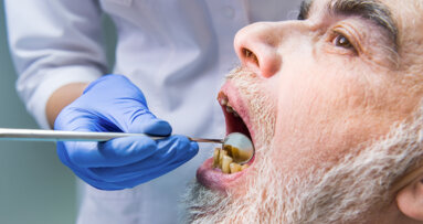 Seniors’ perception of oral health affects treatment seeking, study says