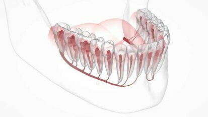 Umělá inteligence může být nápomocná při zavádění dentálních implantátů v lokalizaci mandibulárních kanálů