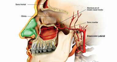La importancia de la anatomía sinusal