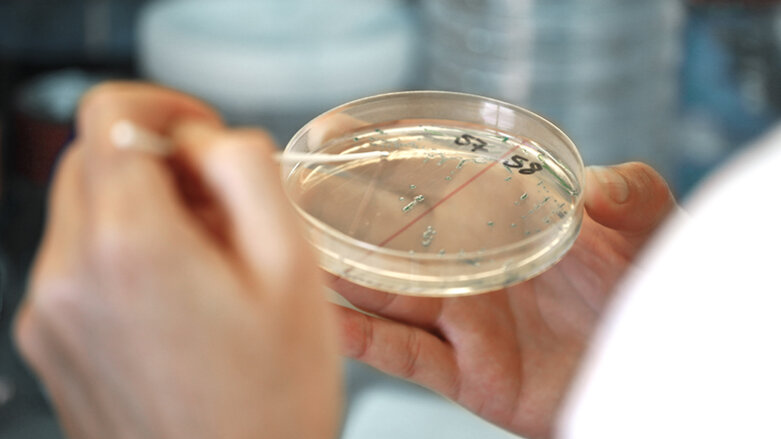 UZH: Antibiotika mit neuartiger Wirkung entdeckt