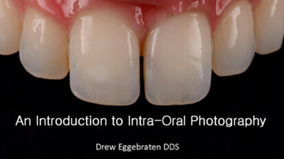 An Introduction to Intra-Oral Photography
